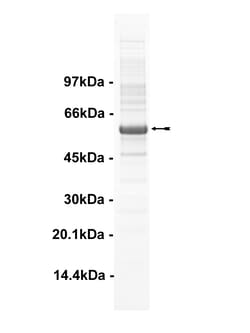 Eurofins DiscoverX Tec Protein, Activated 10 &mu;g | Buy Online | Eurofins DiscoverX | Fisher Scientific